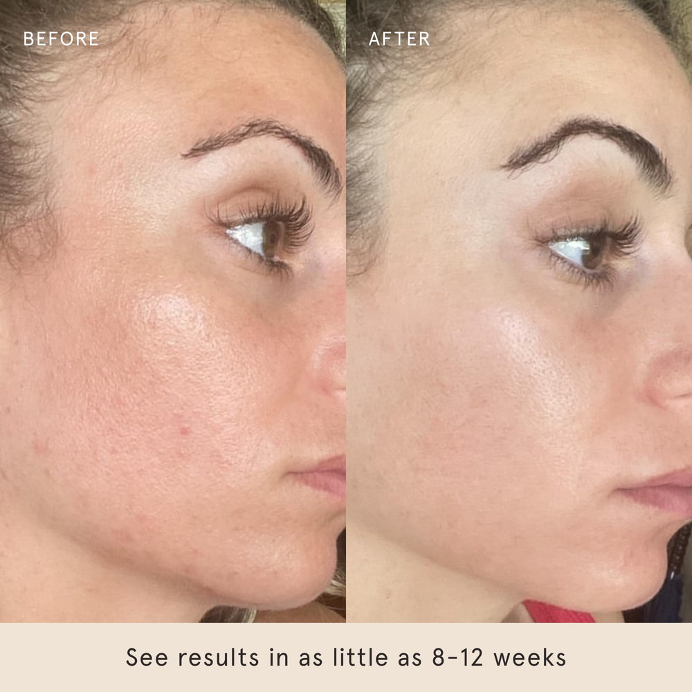 Barefaced Liquid Gold serum 15% vitamin C for even skin tone.