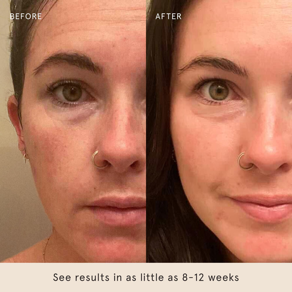Barefaced Overachiever fine-lines focus illustrating potential wrinkle-softening benefits.
