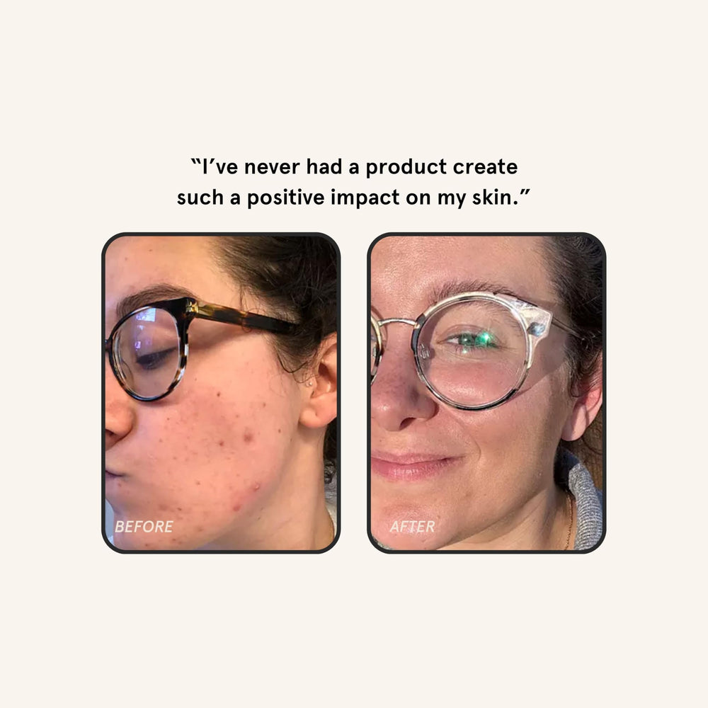 Barefaced Overachiever hydration-glow close-up demonstrating lightweight, serum-like texture.