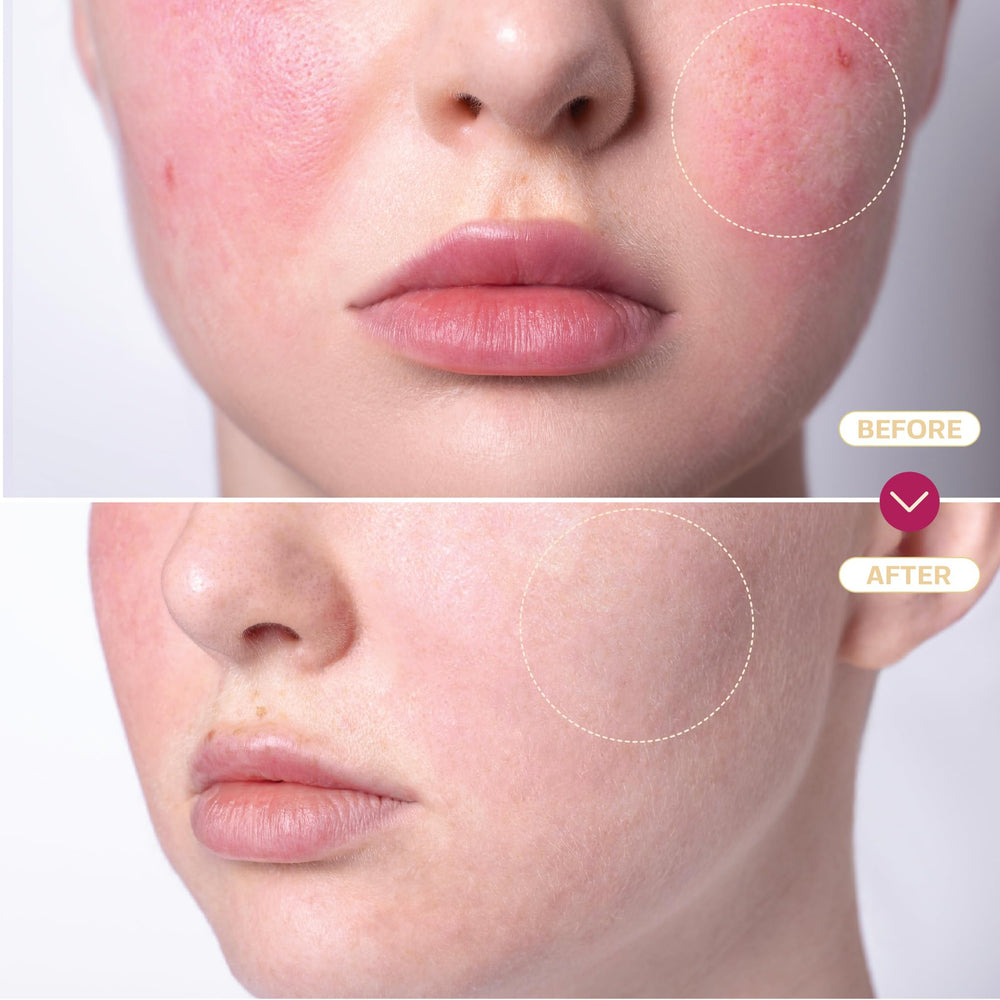 BASE LABORATORIES hypochlorous spray on clean facial area demonstration