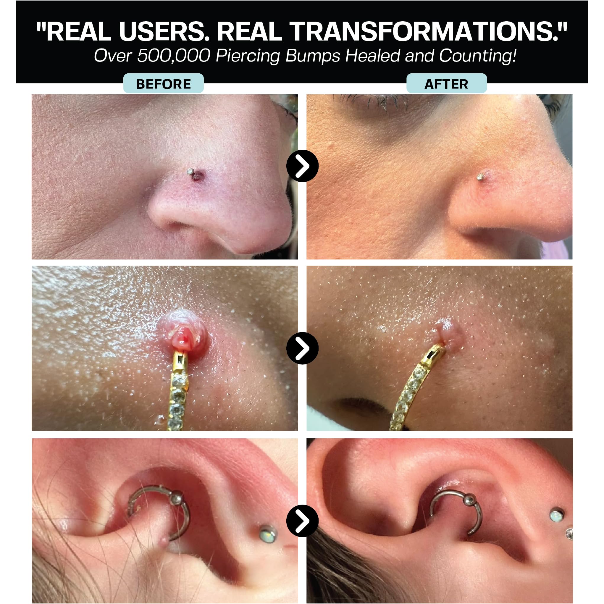 BASE LABORATORIES nose-piercing-cleaner shows precise cleaning to reduce irritation.