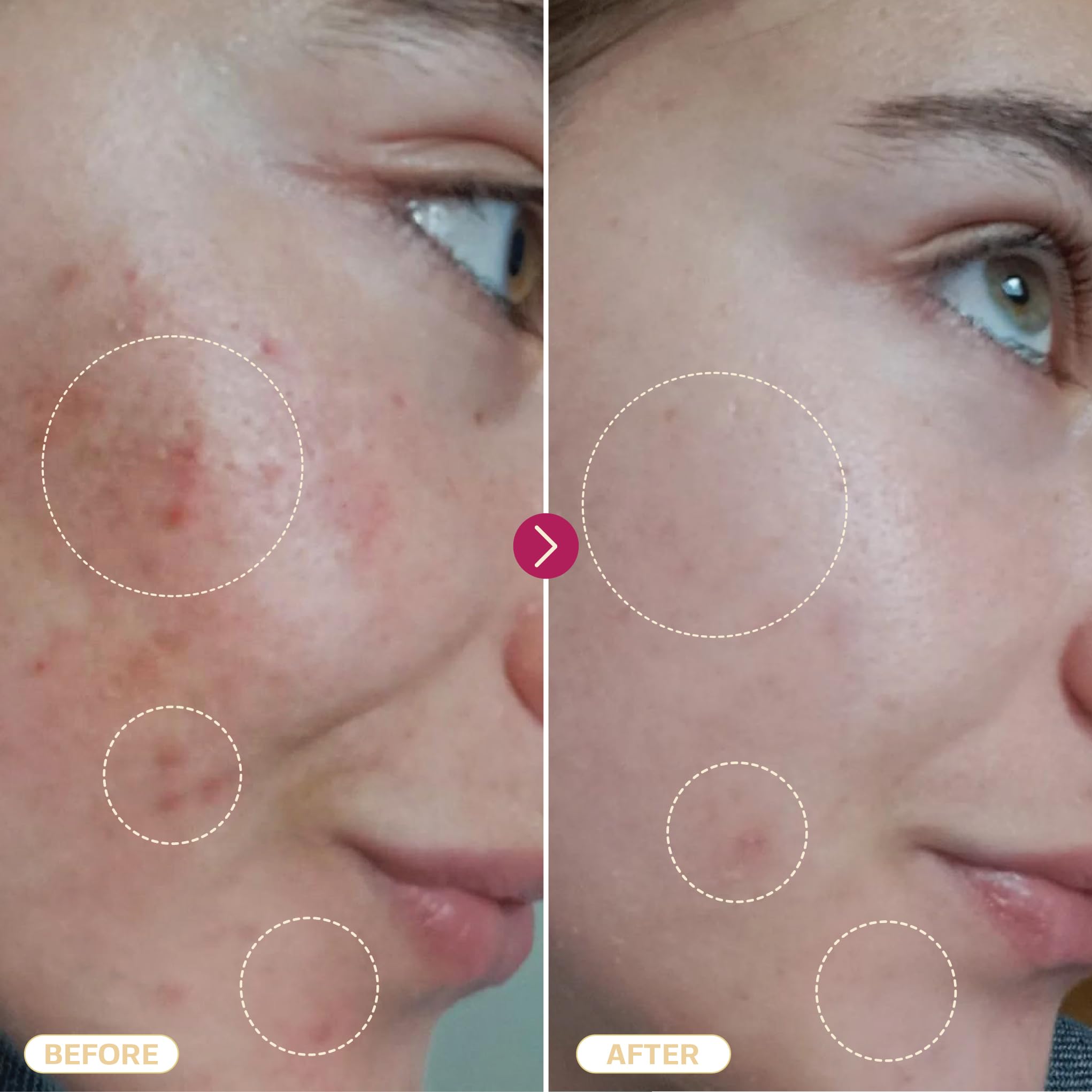 BASE LABORATORIES hypochlorous skin-care routine with spray and wipes