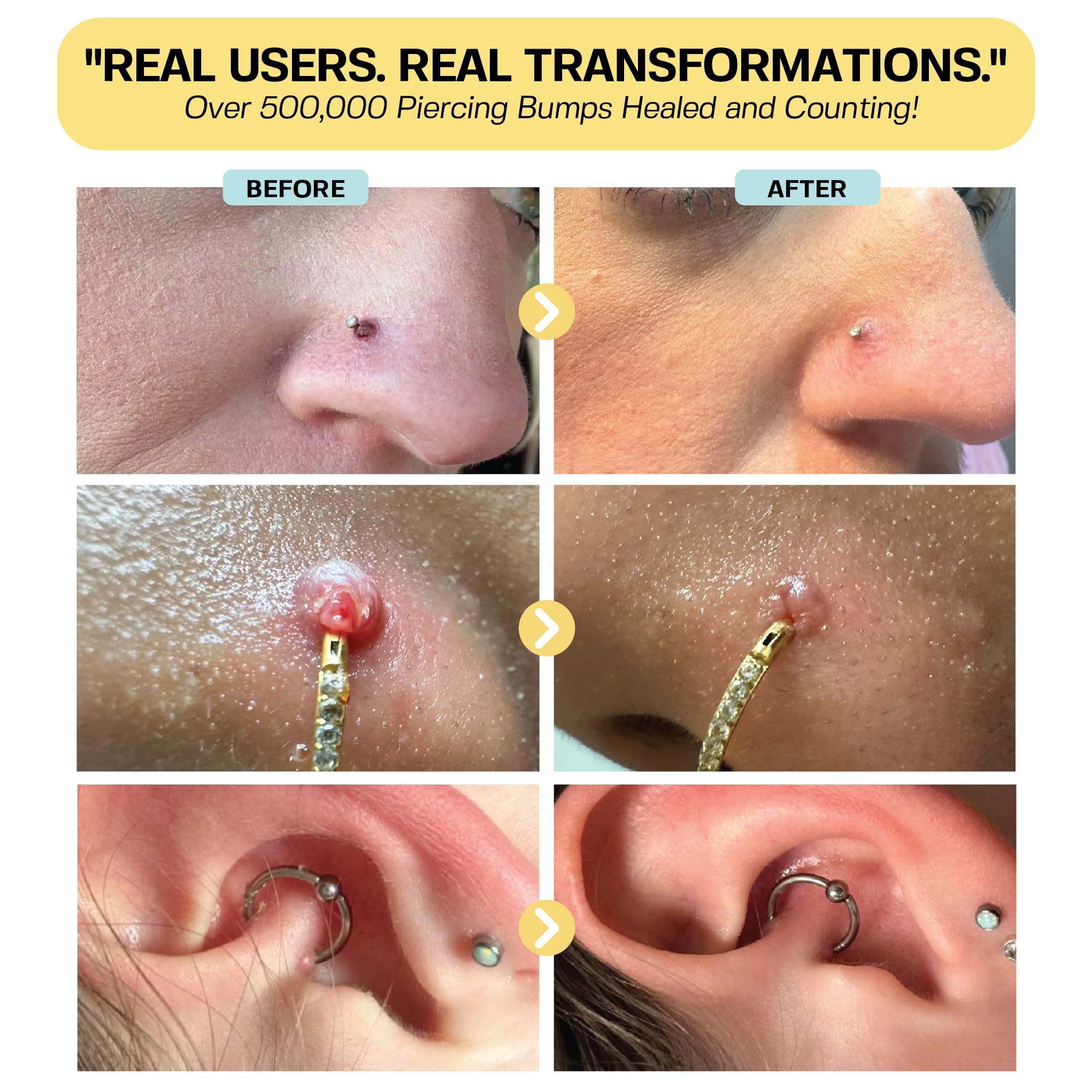 BASE LABORATORIES keloid bump removal drops applying gently on skin.