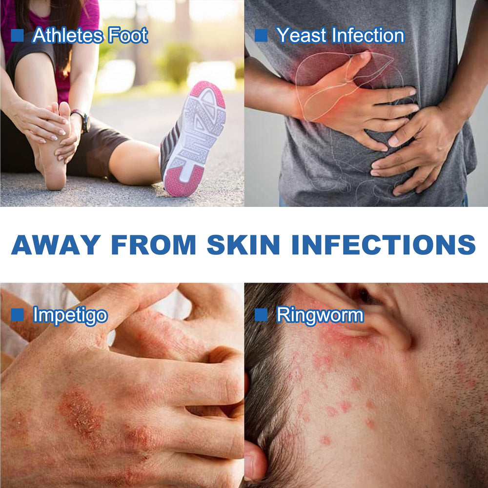 Battleskin antifungal soap-bar-hands-body-use demonstrates gentle daily use on hands and body.