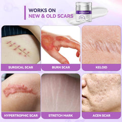 BAUTVAS Advanced Scar Cream texture closeup shows lightweight gel formula.