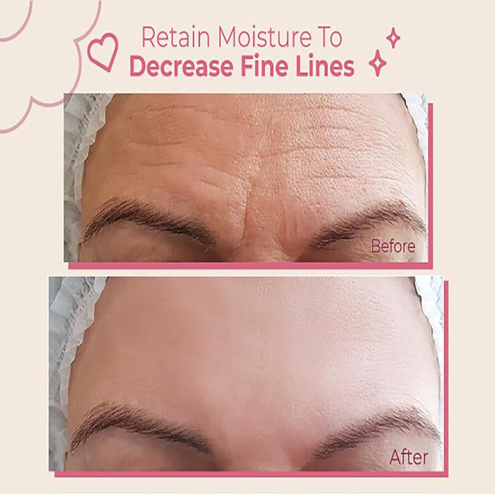 Bayside Forehead Wrinkle Patches closeup highlighting flexible, skin-friendly material for comfortable wear.