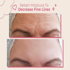 Bayside Forehead Wrinkle Patches closeup highlighting flexible, skin-friendly material for comfortable wear.