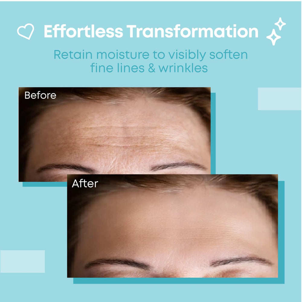 Bayside forehead wrinkle patches close-up displaying soft texture for comfortable nightly wear.
