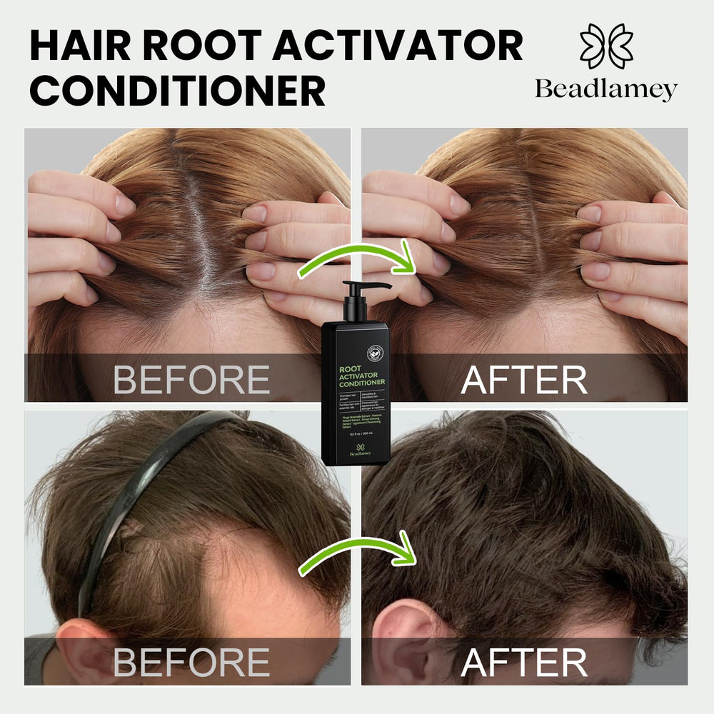 Beadlamey Root Activator Conditioner botanical blend supports scalp health and comfort