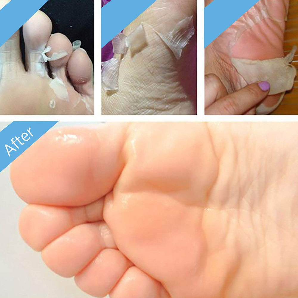 Bealuz foot peel mask aftercare steps for soft refreshed feet