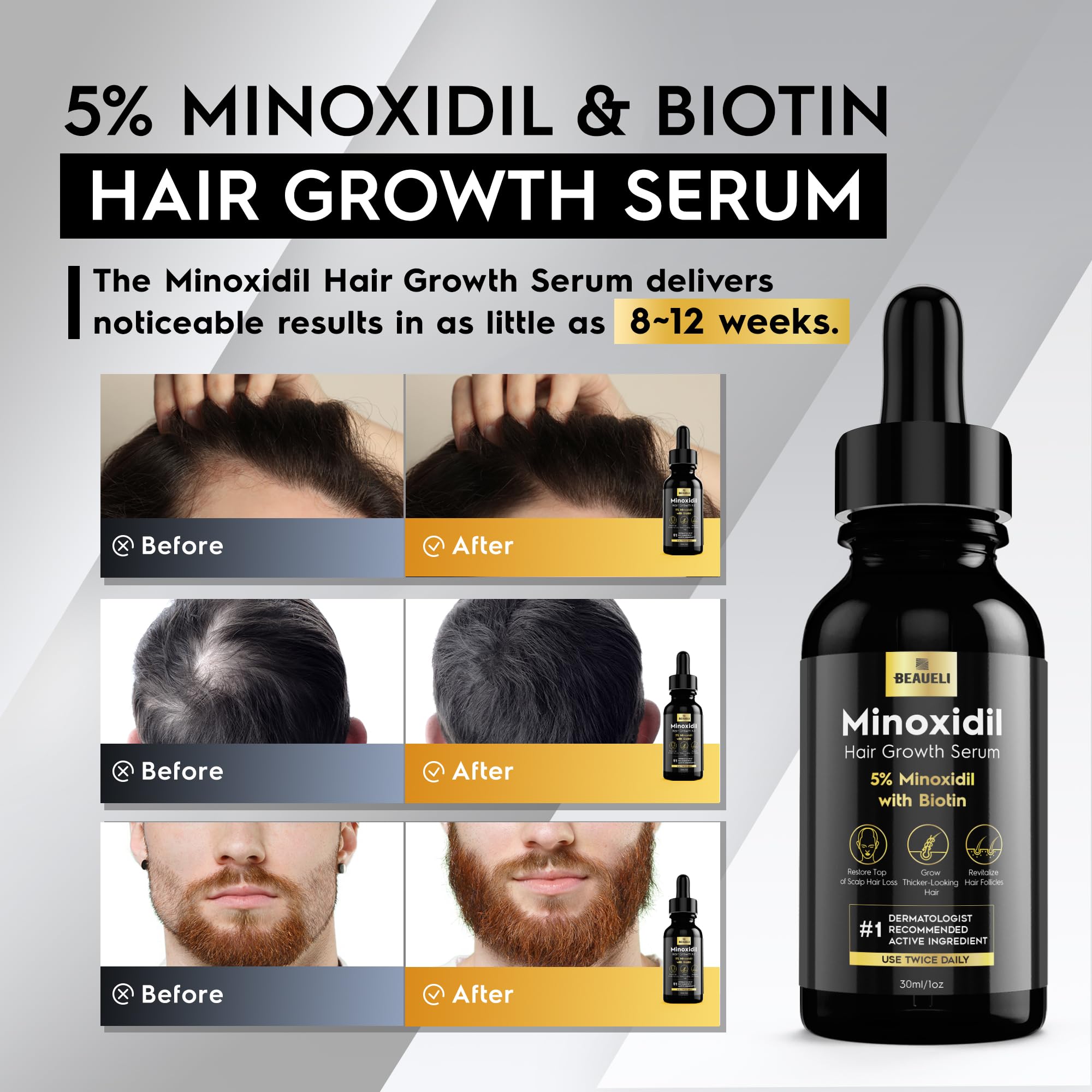 Beaueli Minoxidil application dropper demonstrates precise dosing for even, consistent treatment.