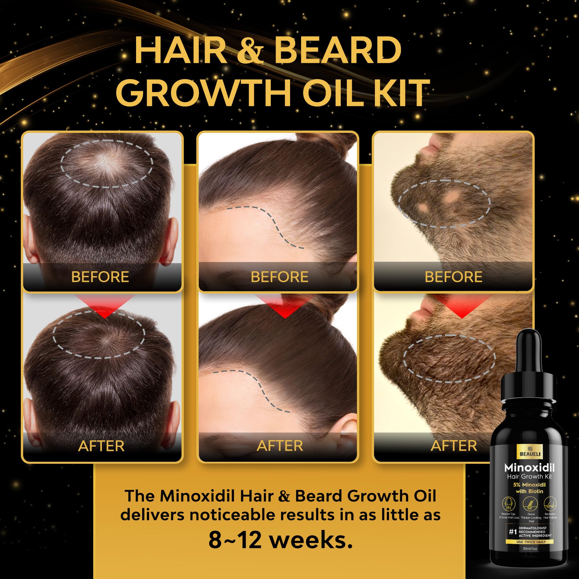 Beaueli Minoxidil beard growth application shown for daily use.