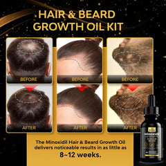 Beaueli Minoxidil beard growth application shown for daily use.