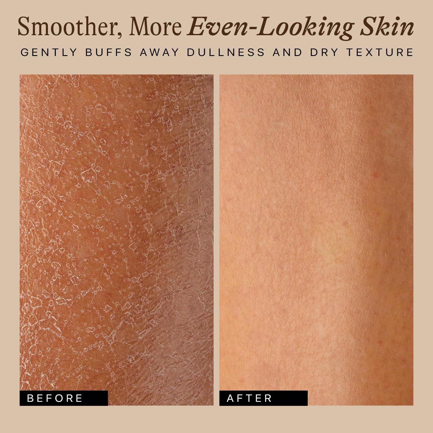 Beauty by Earth cellulite-massage brush helps improve skin texture and tone