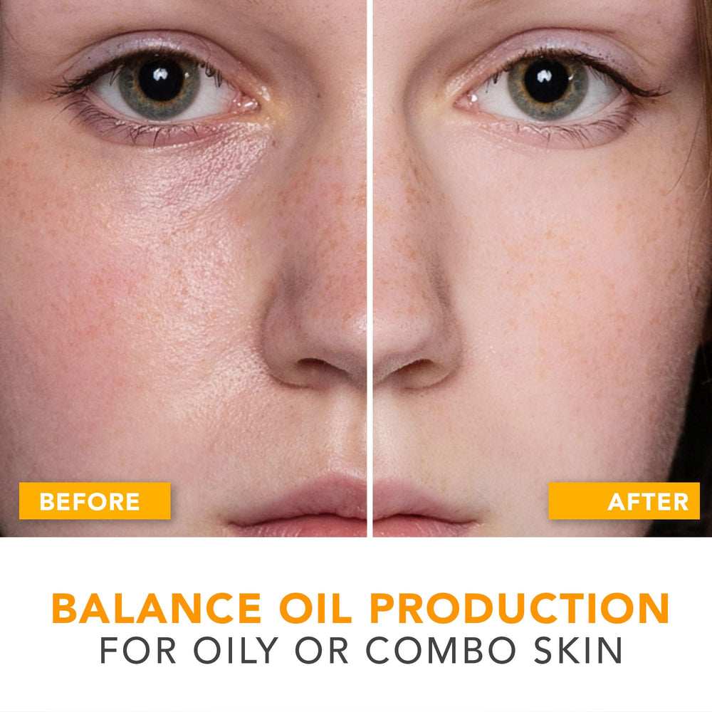Beauty by Earth oil-control moisturizer bottle, USA-made with natural ingredients for acne-prone skin.