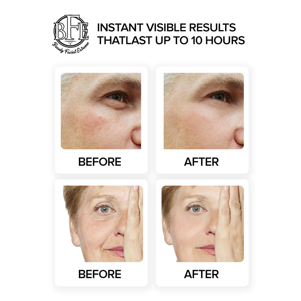 Beauty Facial Extreme skin-smoothing-and-fine-lines-visual focuses on a youthful under-eye appearance.