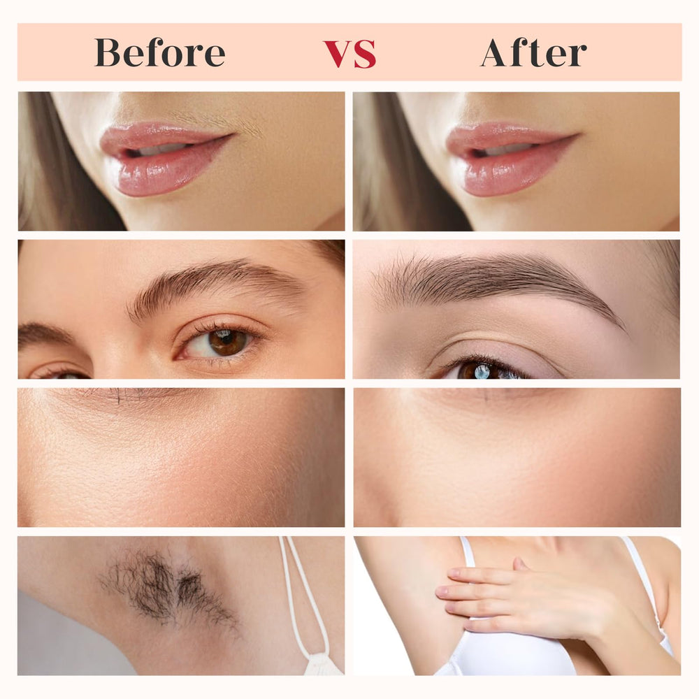 BECHY gen3 pack includes four heads and one cleansing brush for extended use.