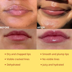 Propolis-wax blend in Bee Balm Lip Balm provides protective softness.