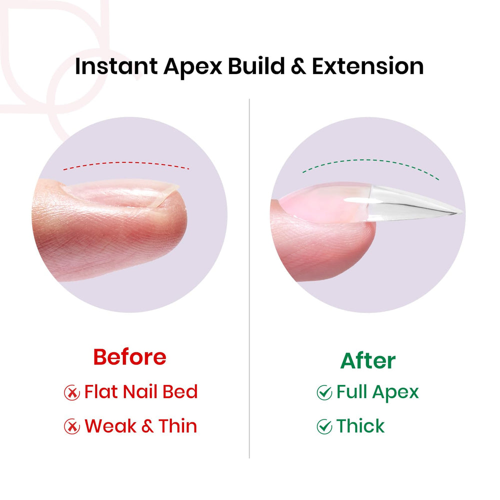 Beetles Tipex pre-etched tip set offers quick application and secure fit