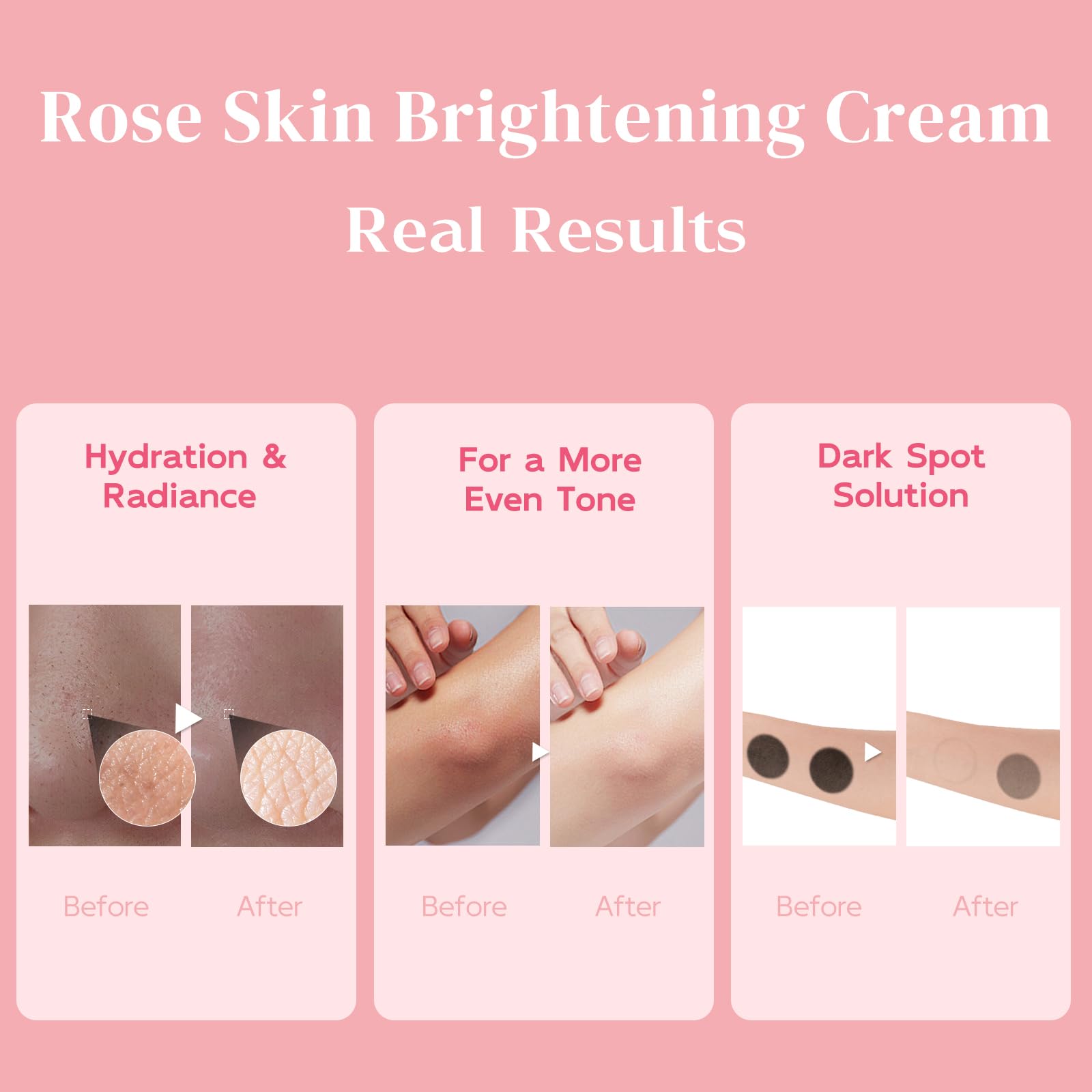BELIARST brightening cream on inner thigh area.