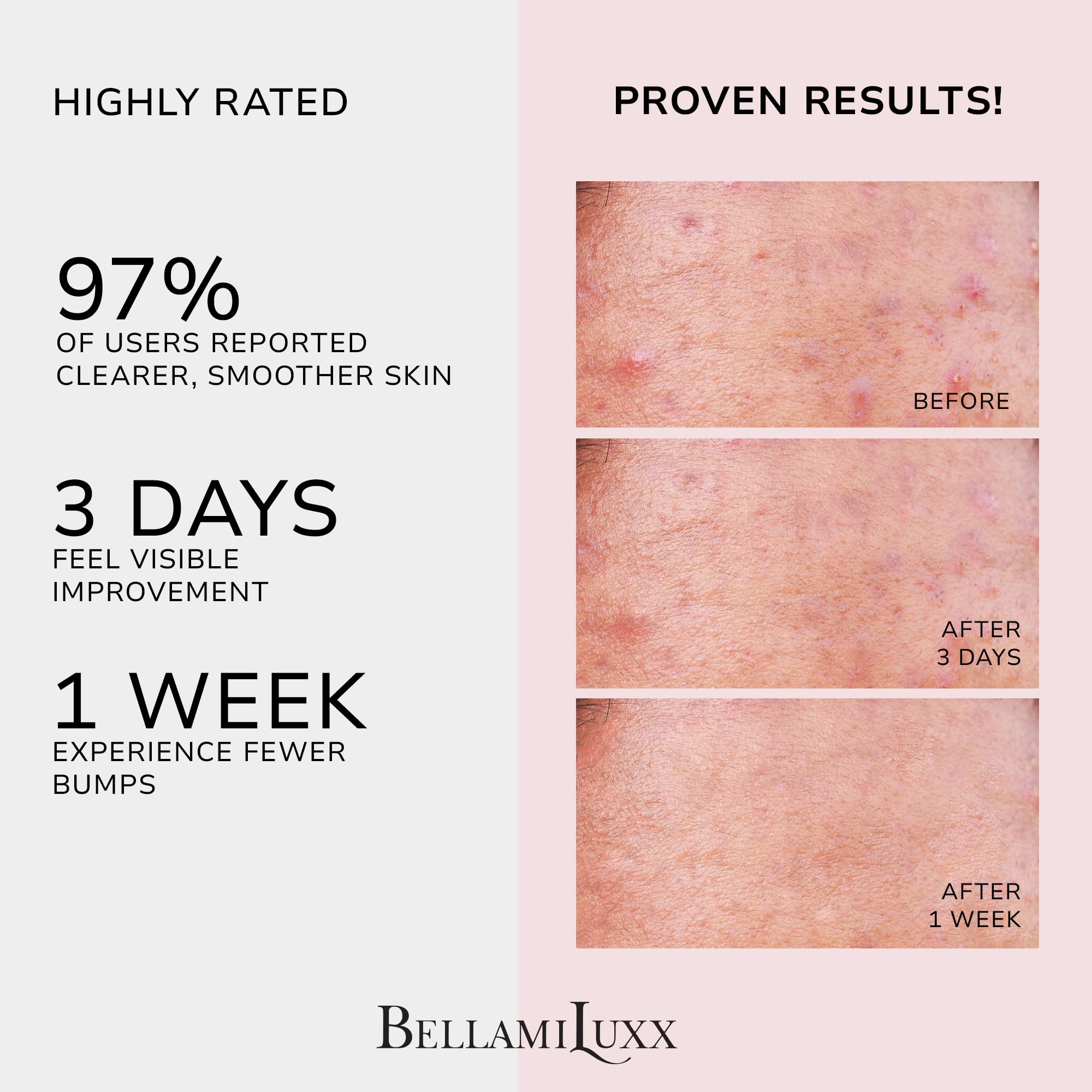 BellamiLuxx back blemish closeup highlights pore-purifying action and calming effect