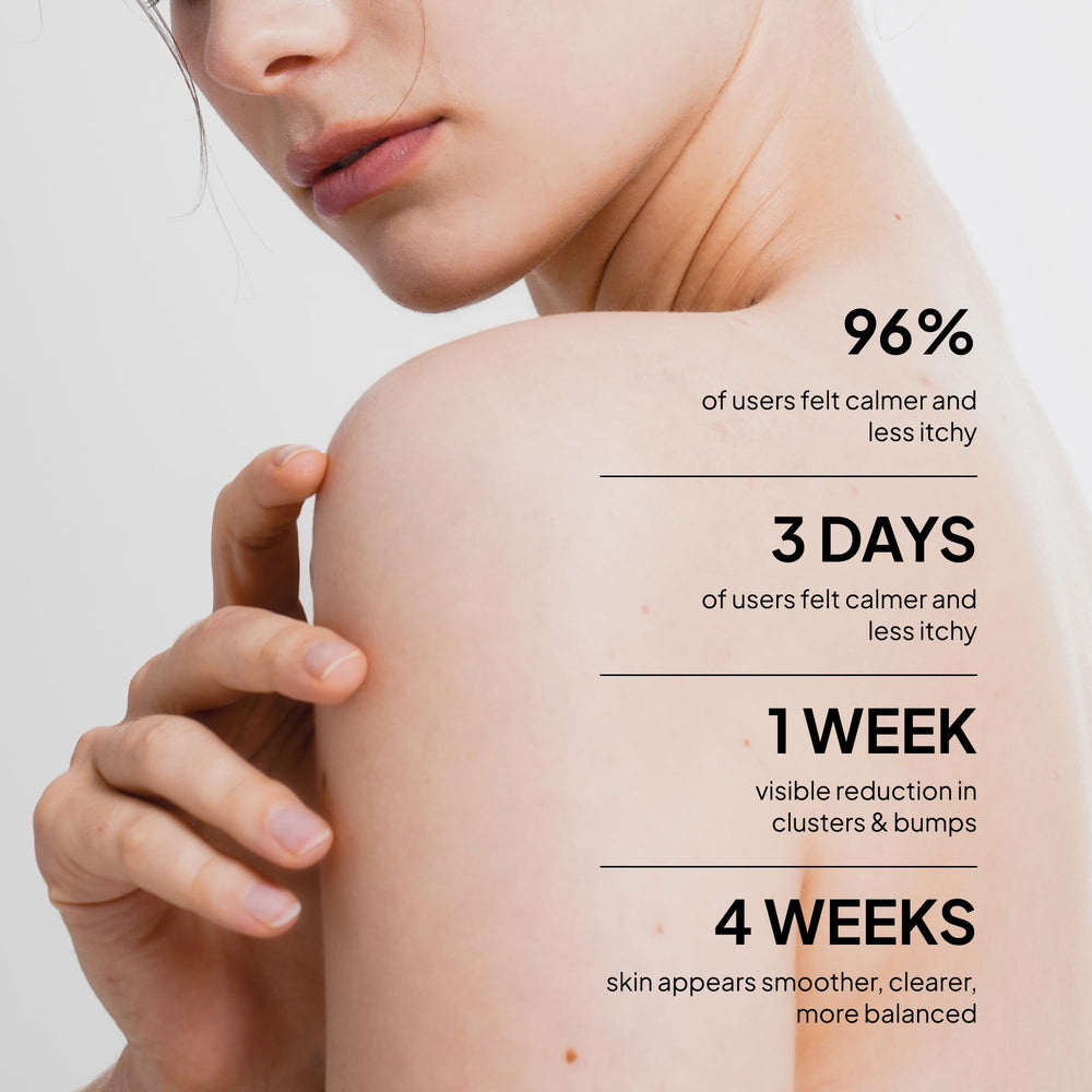 BellamiLuxx back-shoulder-breakouts-closeup highlights targeted care for breakout-prone areas.