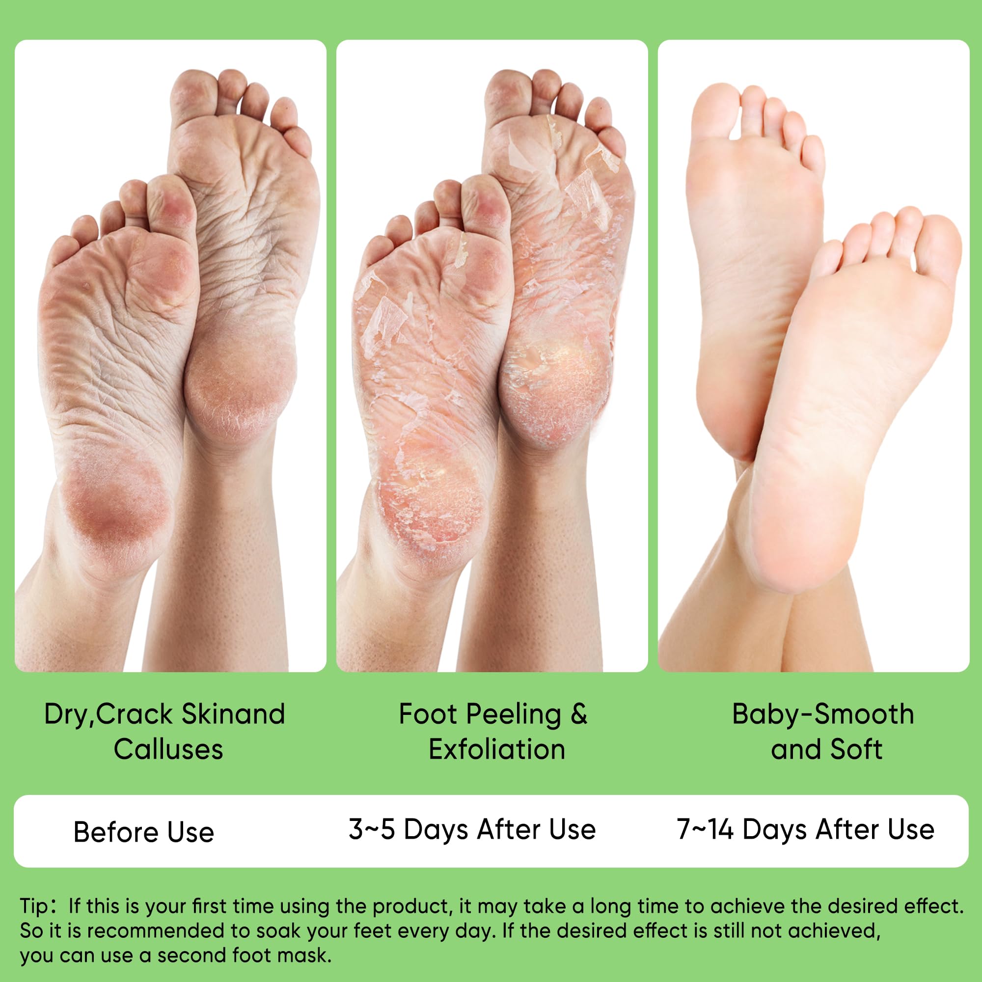 Berlaney Aloe Foot Peel ingredients highlight aloe extracts for gentle renewal.
