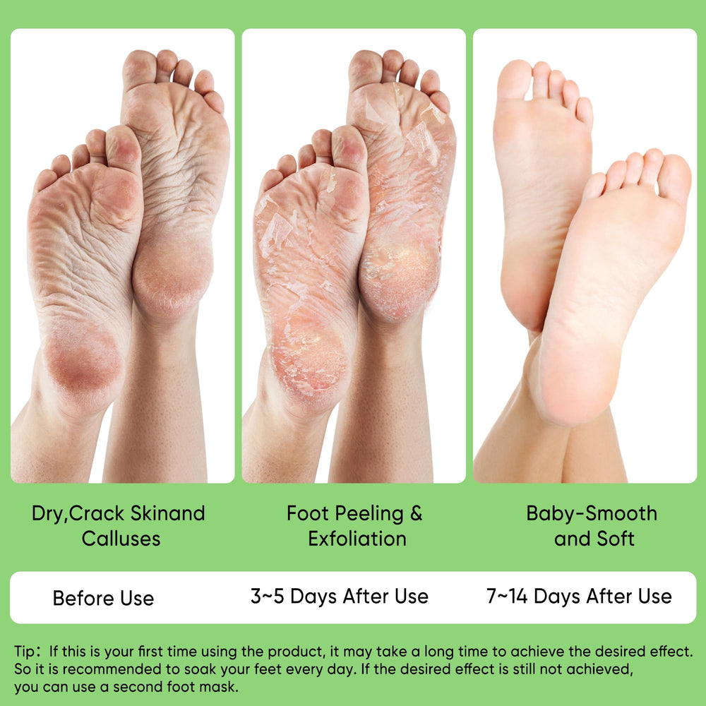 Berlaney Aloe Foot Peel ingredients highlight aloe extracts for gentle renewal.