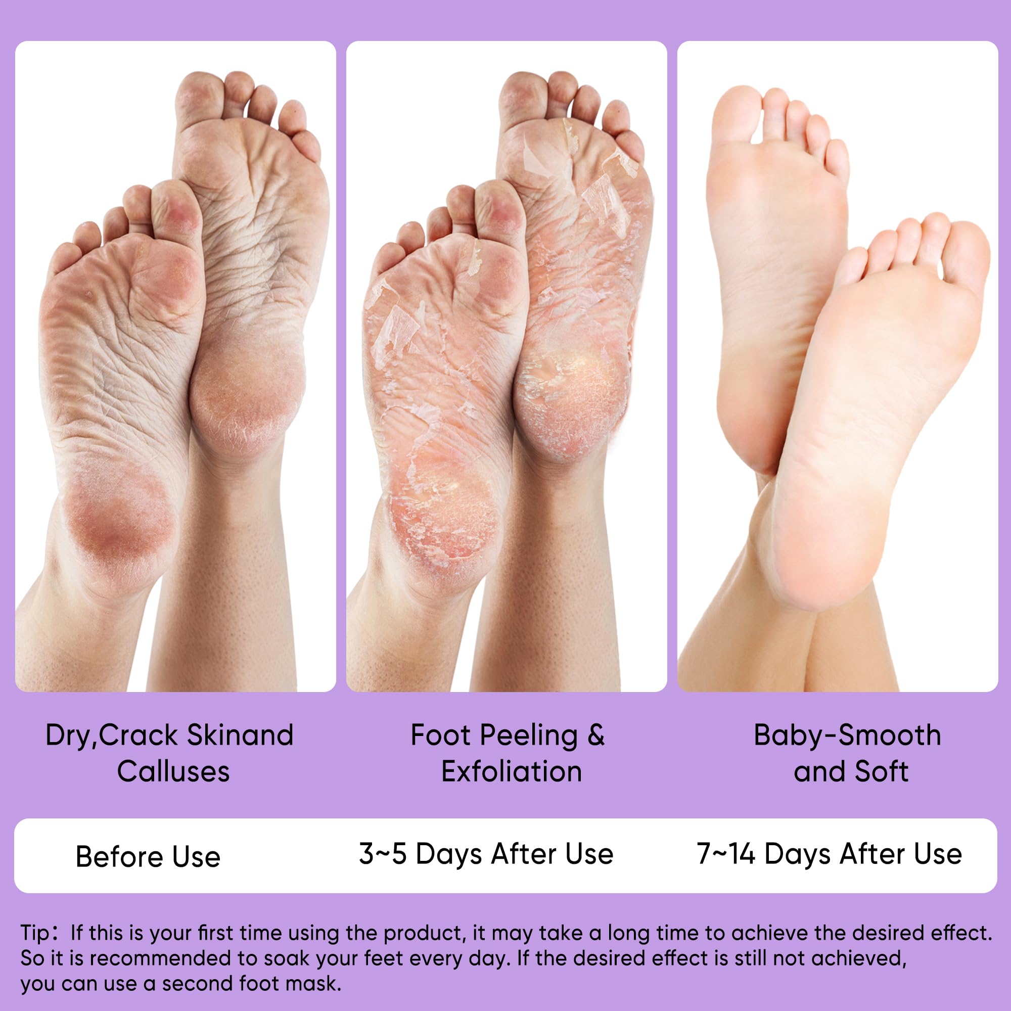 Berlaney Foot Peel Mask after-use feet feel soft and smooth