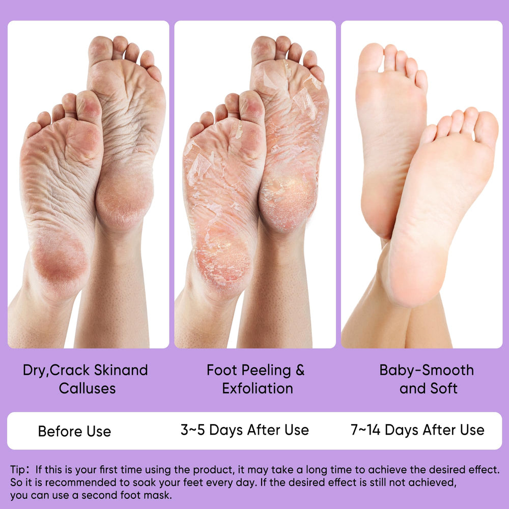 Berlaney Foot Peel Mask after-use feet feel soft and smooth