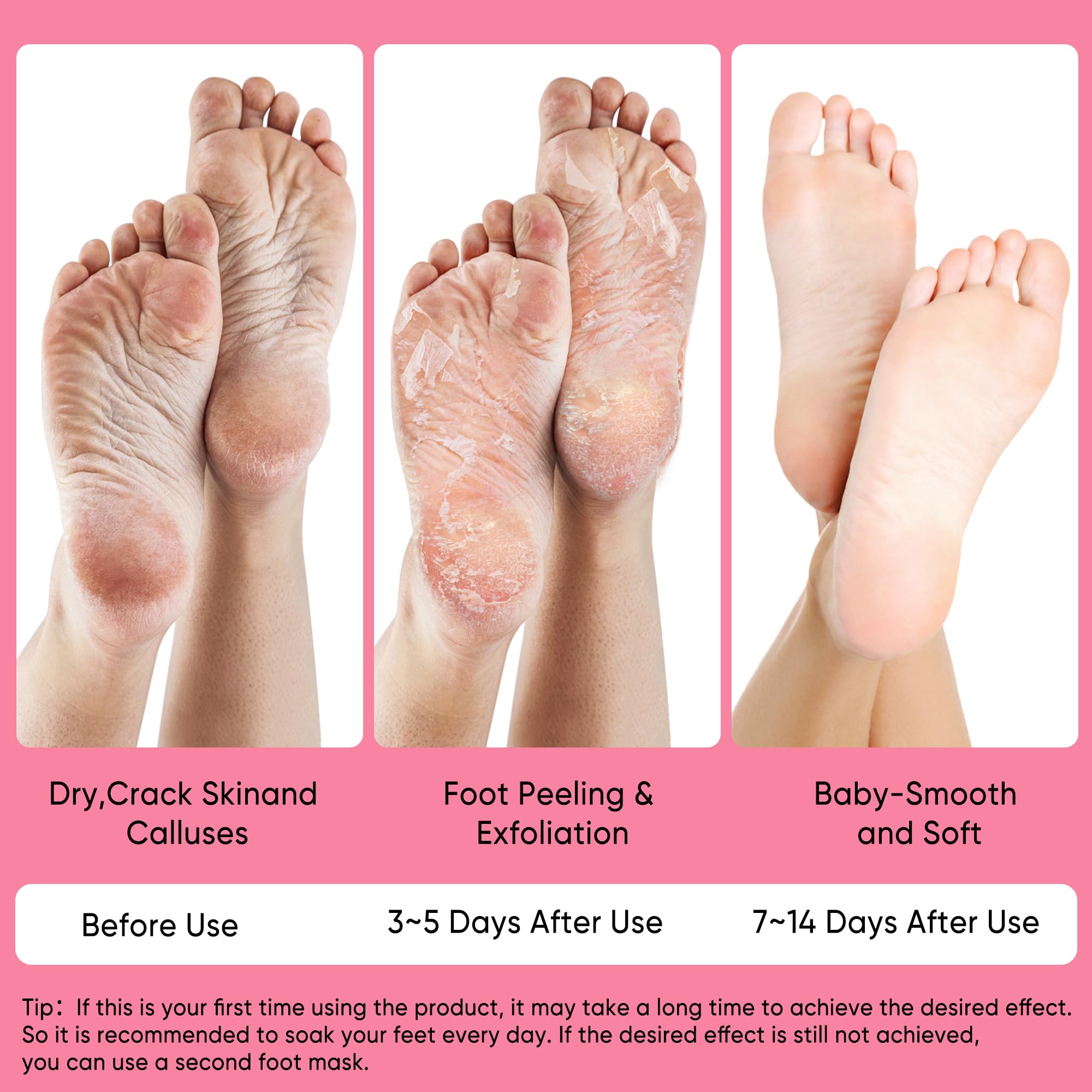 Berlaney Peach Foot Mask highlights plant-based formula with peach acids