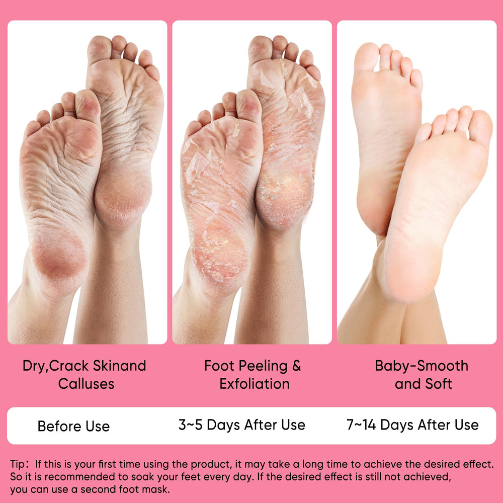 Berlaney Peach Foot Mask highlights plant-based formula with peach acids