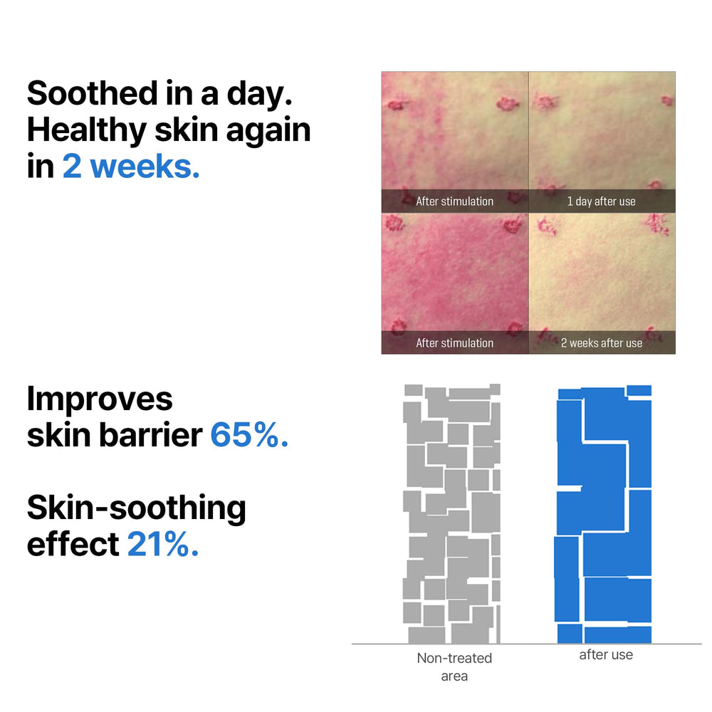 SOME BY MI Beta-Panthenol Serum on hand shows light texture and quick absorption.