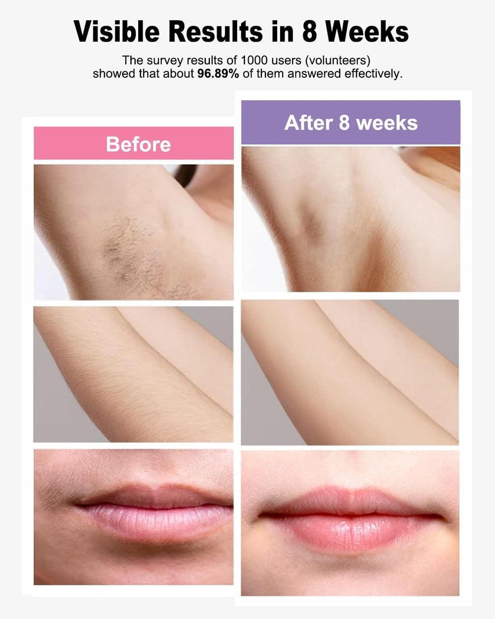 BETNEP IPL laser removal device handheld usage demonstrates comfortable grip during quick sessions.