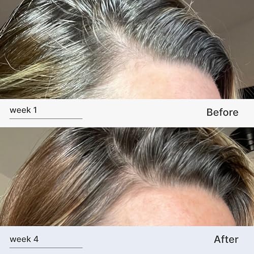 Better Not Younger ginger and Centella Asiatica bottle highlighting scalp vitality