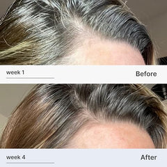 Better Not Younger ginger and Centella Asiatica bottle highlighting scalp vitality
