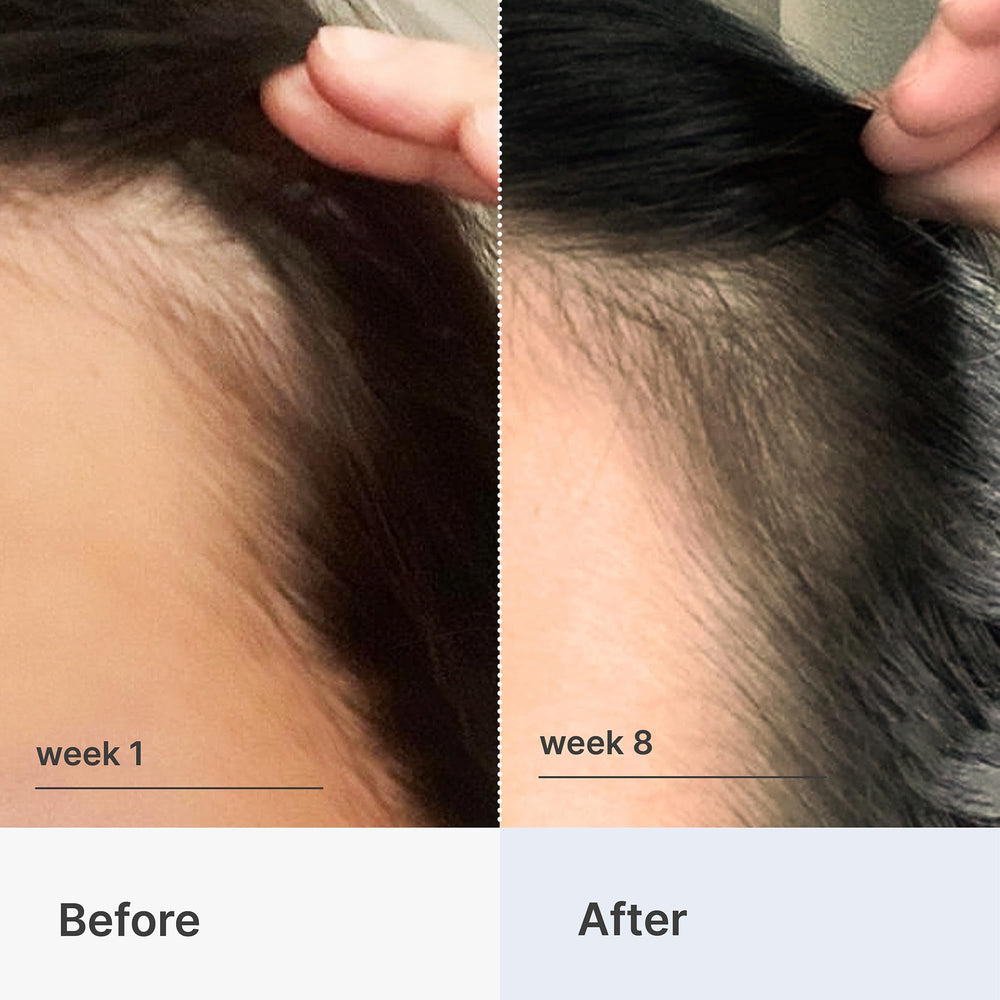 Better Not Younger silky serum drop settling into scalp