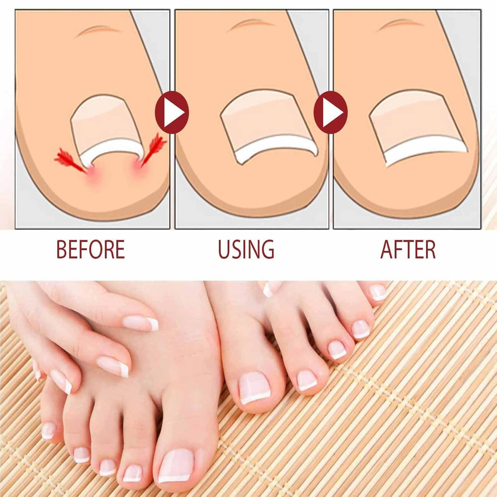 Beuifvo nails on fingers and toes in use