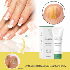 Beuifvo natural nail repair care gel 20ml bottle for cuticle hydration