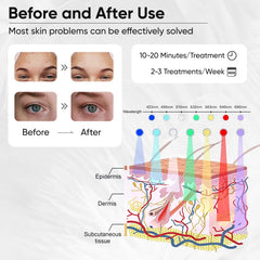 Beuwe face mask color-modes selector with seven options for targeted skincare