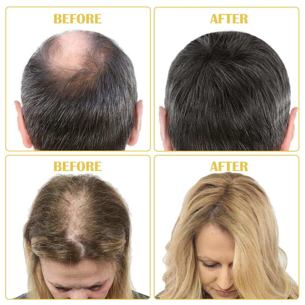 Bieyoc Minoxidil Serum bottle and safe formula label