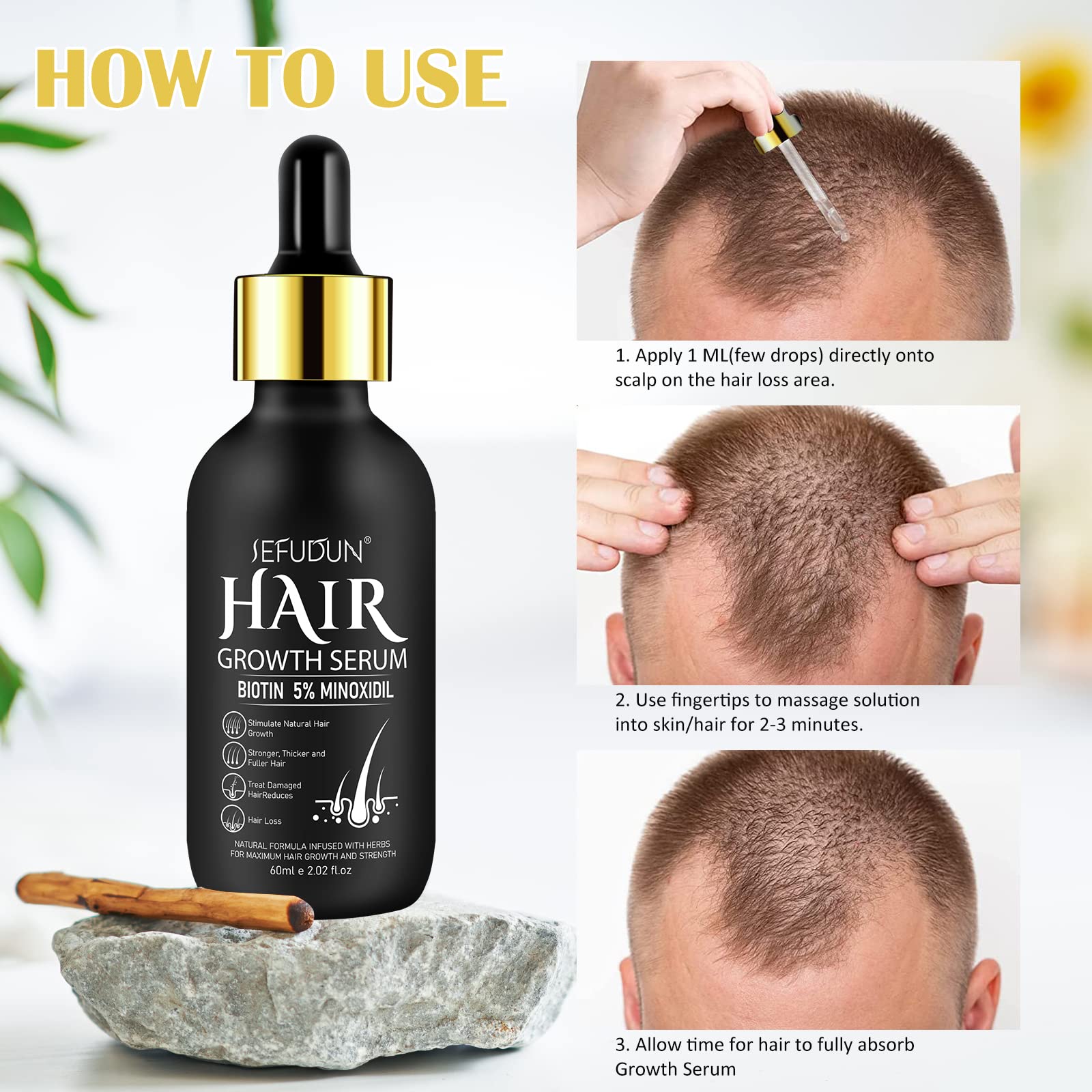 Bieyoc Minoxidil Serum daily-use scene for routine hair care
