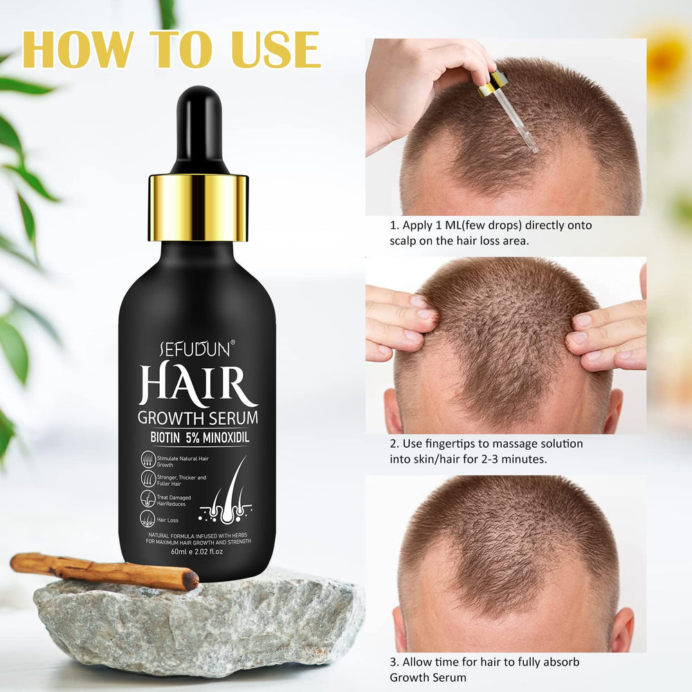 Bieyoc Minoxidil Serum daily-use scene for routine hair care