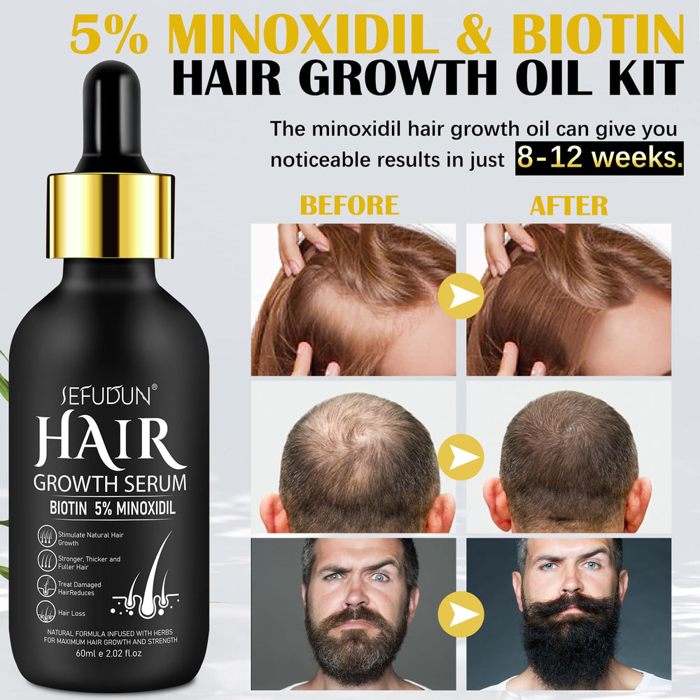 Bieyoc Minoxidil Serum dropper dispensing for precise scalp application