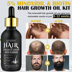 Bieyoc Minoxidil Serum dropper dispensing for precise scalp application
