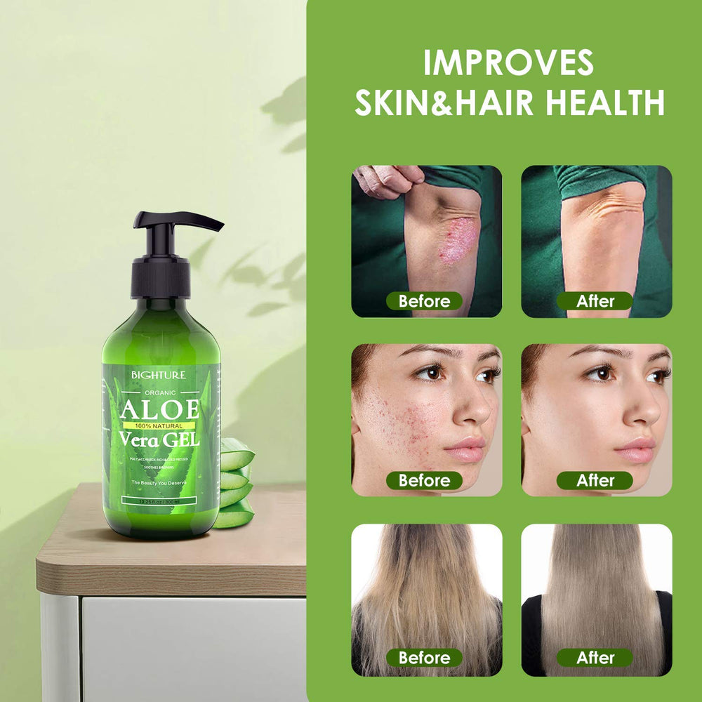 BIGHTURE Aloe Vera Gel helps calm razor burn for sensitive skin.