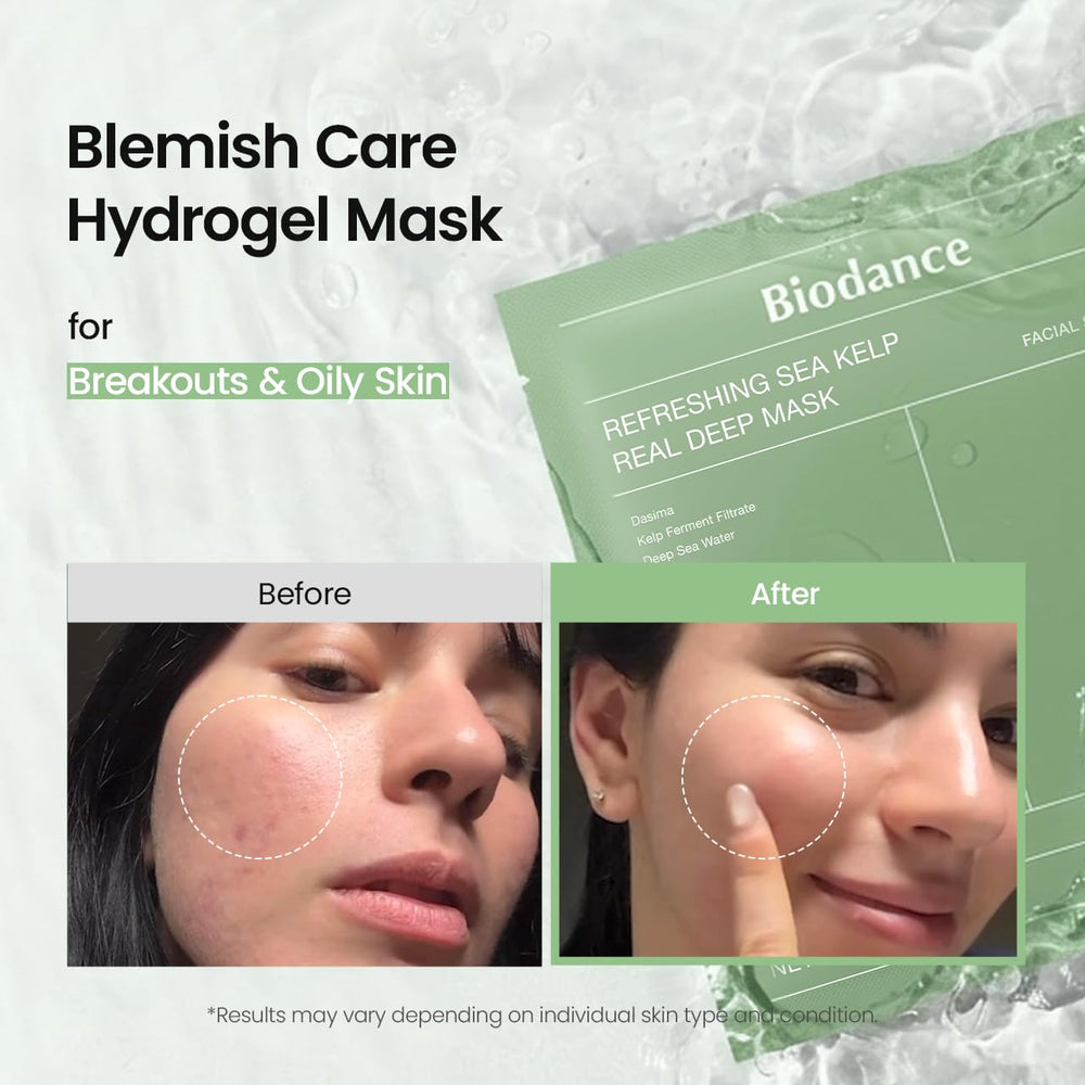 BIODANCE Mask on face with cooling, soothing effect after application.
