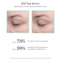 BIOEFFECT EGF Eye Serum texture on skin shows a non-greasy finish.
