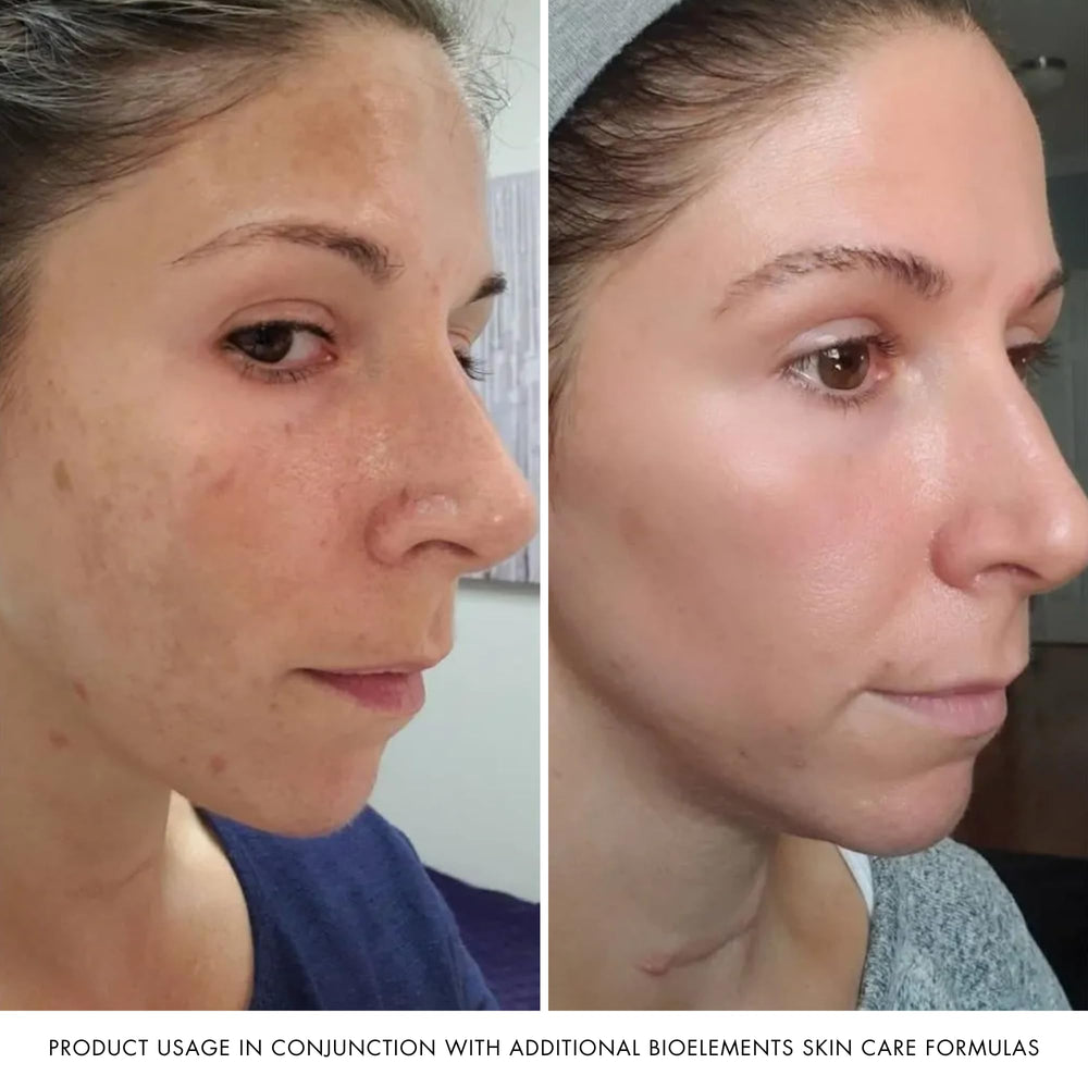 Bioelements Absolute Moisture face application shows absorbed, shine-free finish suitable for daytime routine.