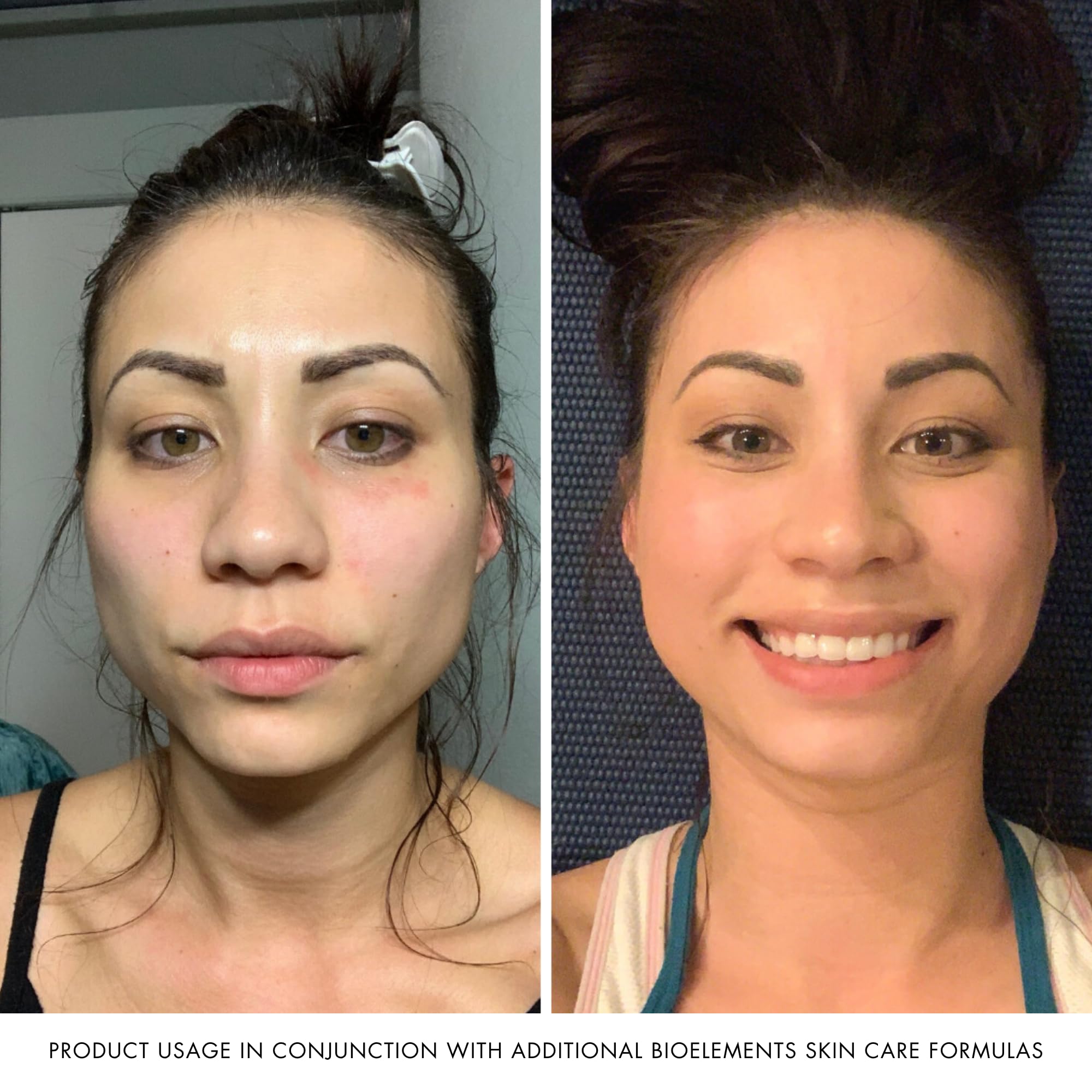 Bioelements Flash Foam Cleanser morning routine usage on face for refreshment